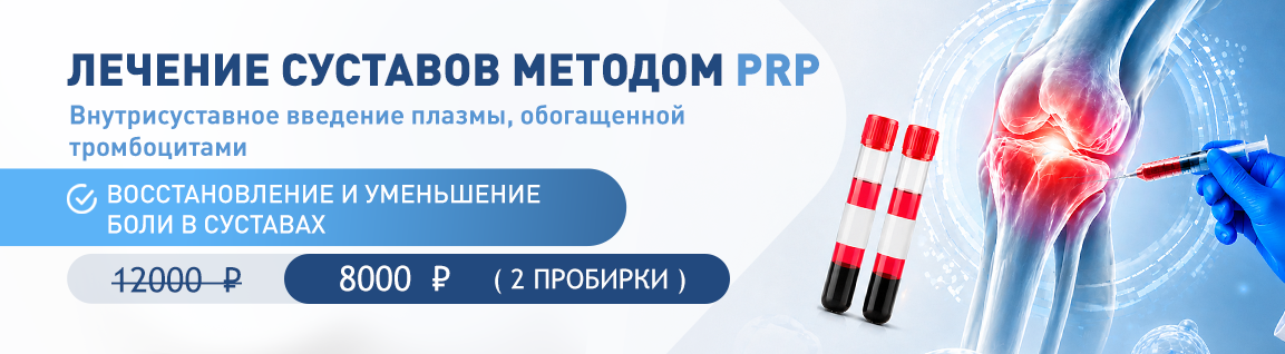 Лечение суставов методом PRP
